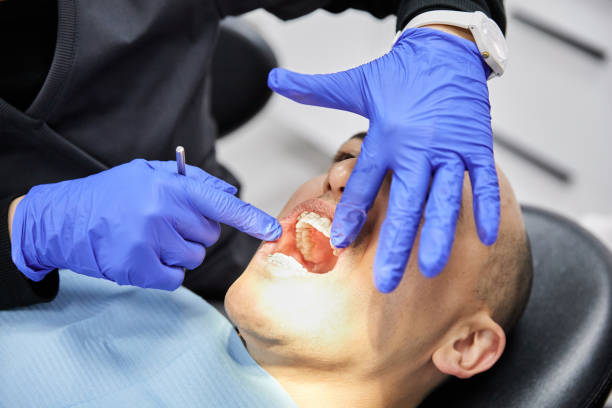 Best Emergency Wisdom Teeth Removal in Port Orange, FL